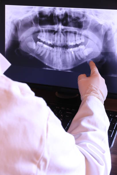Best Emergency Wisdom Tooth Extraction in Guthrie, KY